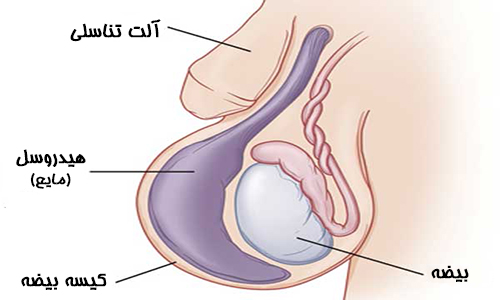 آلت تناسلی دفن شده چیست؟